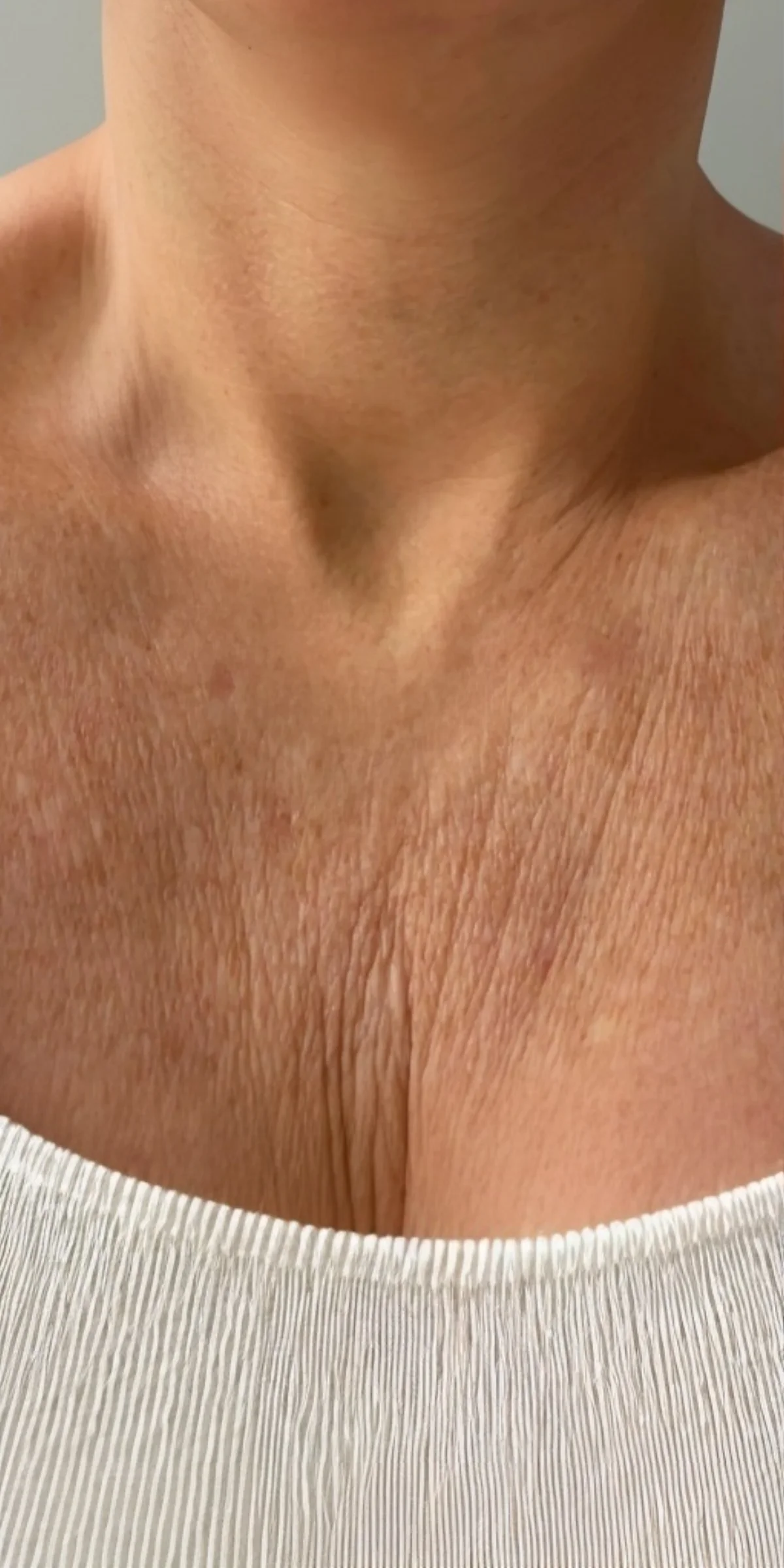 Before on chest