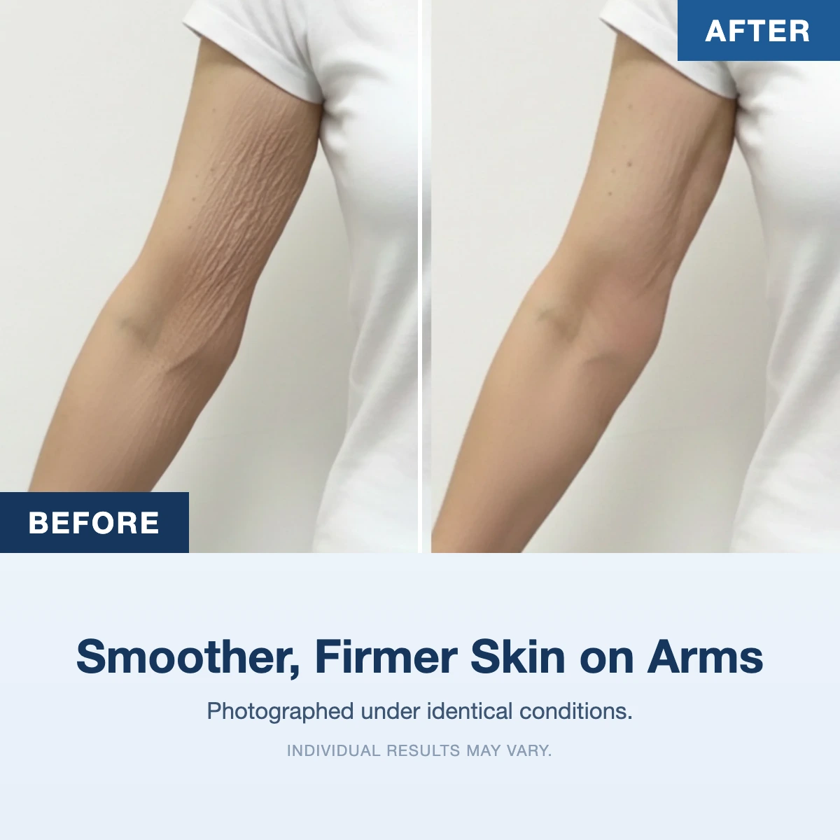 MiamiMD Advanced Crepe Fix product carousel